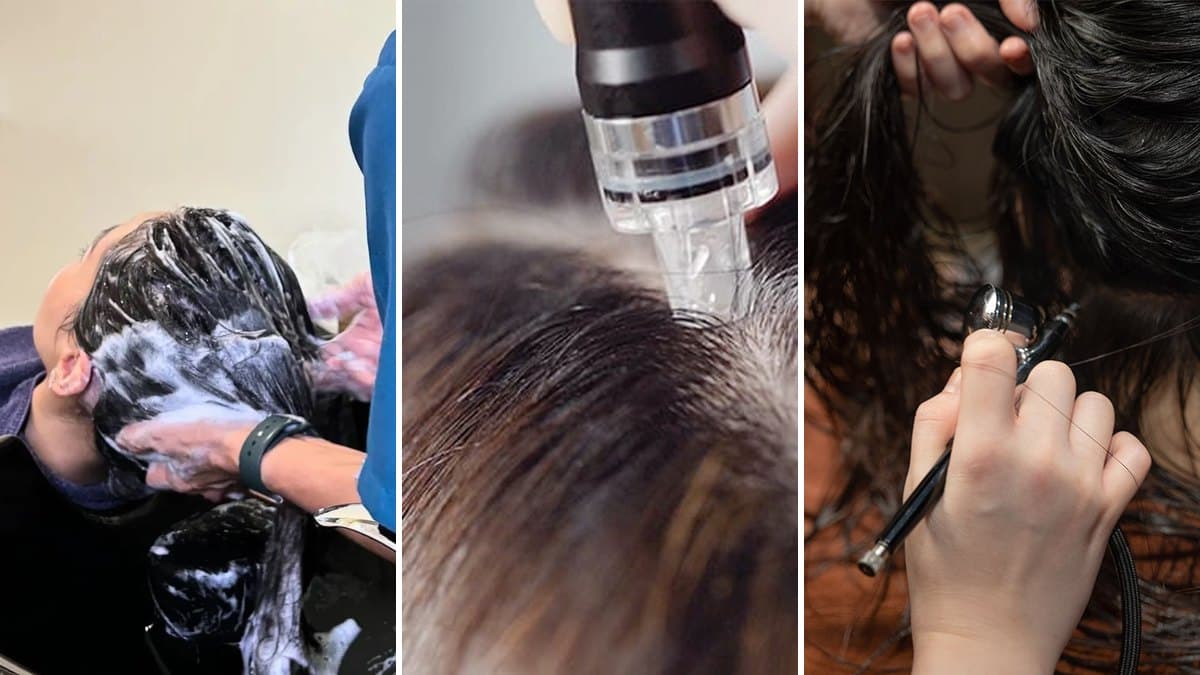 8 Best Hair Loss Treatment Centres in Singapore 2026: First Trials From $28, and What They Really Cost After