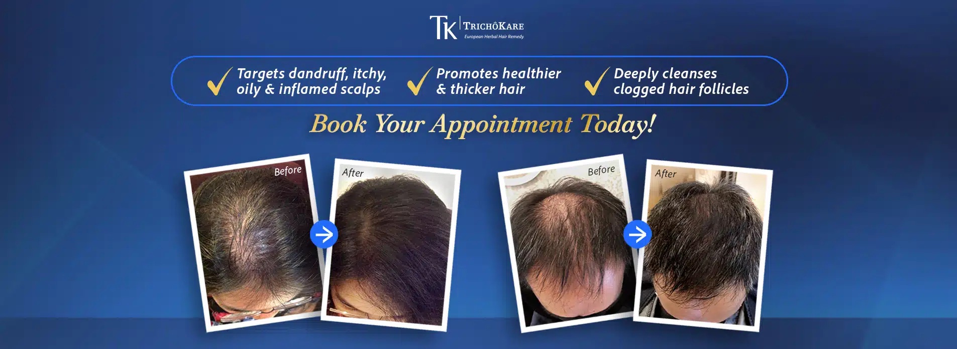 TK TrichoKare: $59.90 Nett for 2.5 Hours, and You Leave With Product